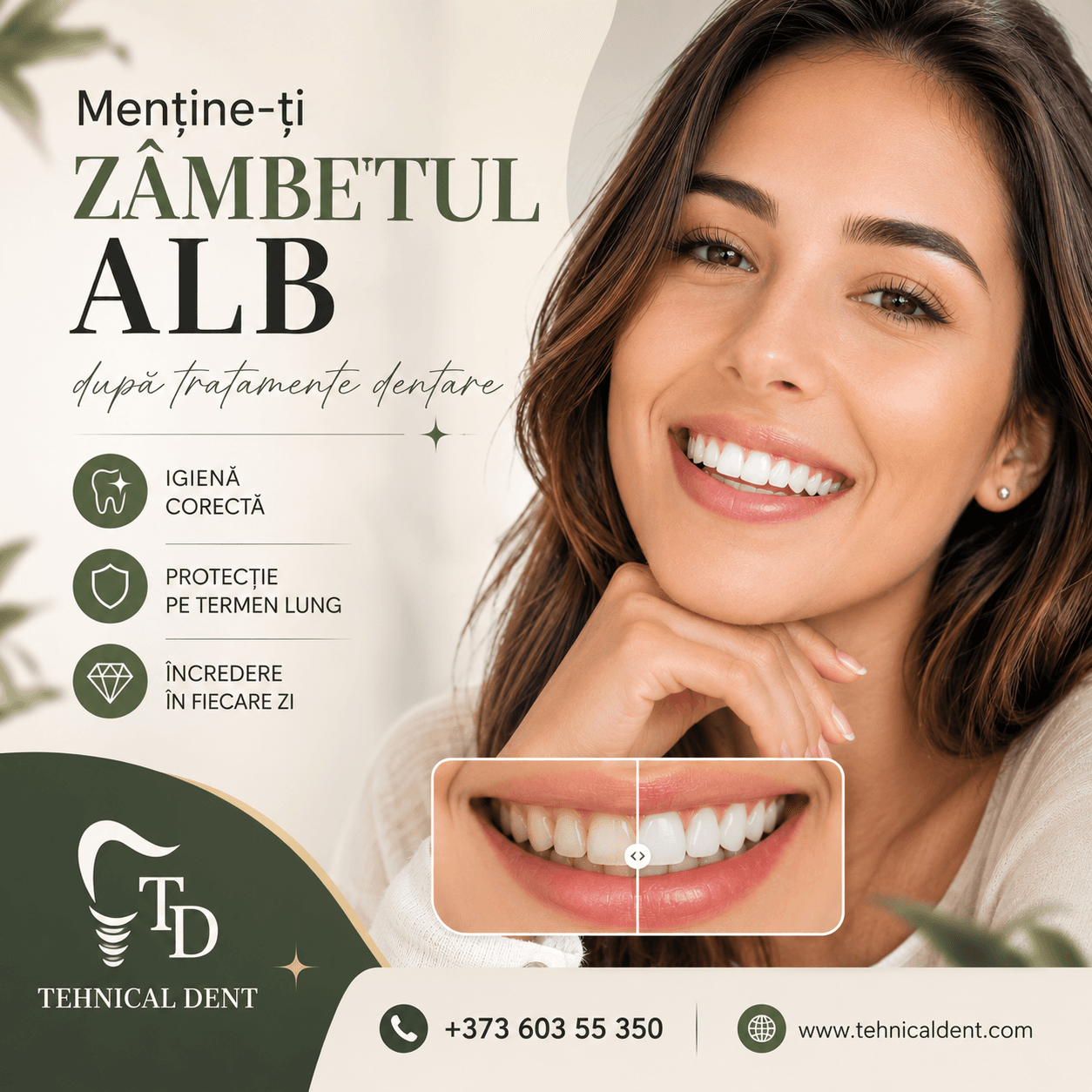 Menține-ți zâmbetul alb după tratamente dentare
