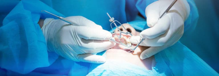 Implantul dentar: tot ce trebuie să știi