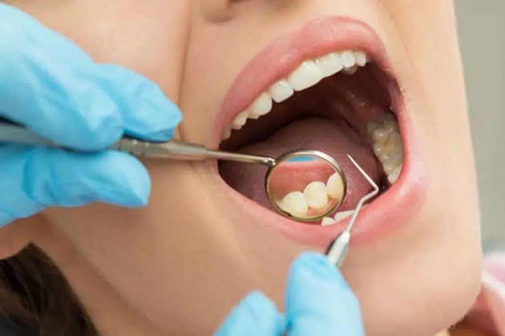 Terapie — General overview